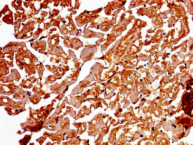 CSB-PA001311LA01HU