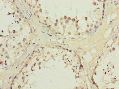 CSB-PA001548LA01HU