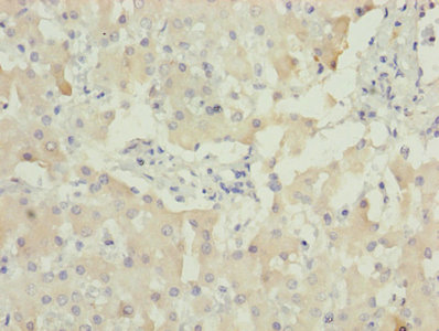 CSB-PA001548LA01HU