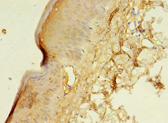CSB-PA002171LA01HU