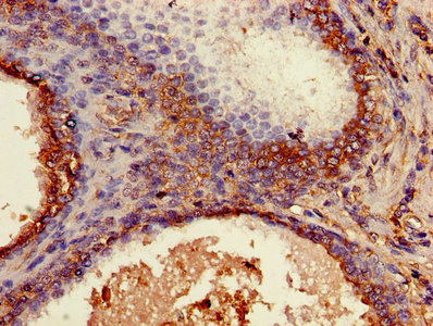 CSB-PA002486YA01HU