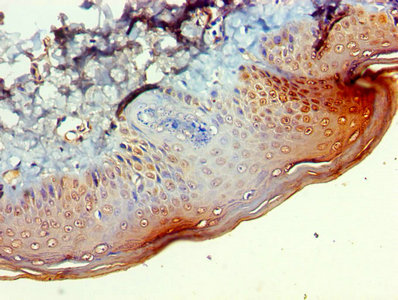CSB-PA002601LA01HU