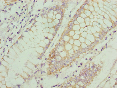 CSB-PA004839LA01HU
