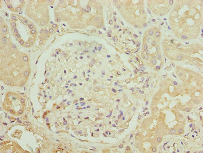 CSB-PA004839LA01HU