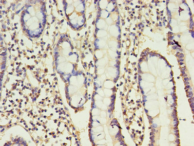 CSB-PA004881EA01HU