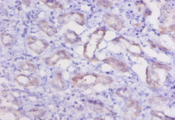 CSB-PA006192LA01RA IHC