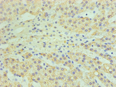 CSB-PA006389LA01HU