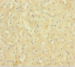 CSB-PA006519HA01HU