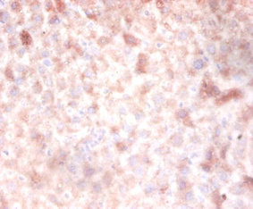 CSB-PA007083LA01HU