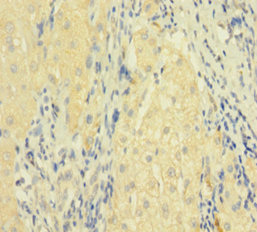 CSB-PA008434LA01HU