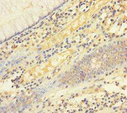 CSB-PA008434LA01HU