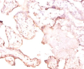 CSB-PA009055LA01HU