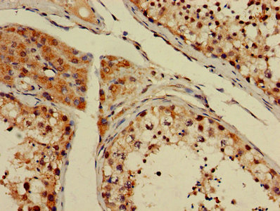 CSB-PA009991LA01HU