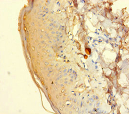 CSB-PA010887LA01HU