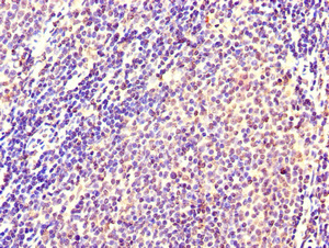 CSB-PA011673HA01HU