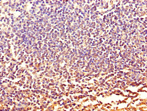 CSB-PA011673HA01HU