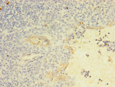 CSB-PA012467LA01HU