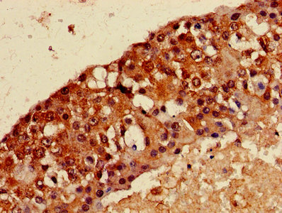 CSB-PA013334LA01HU