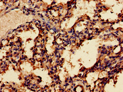 CSB-PA013334LA01HU