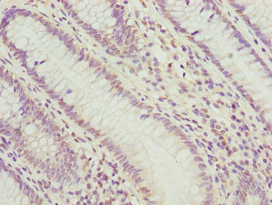 CSB-PA018193LA01HU