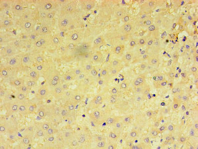 CSB-PA018603LA01HU