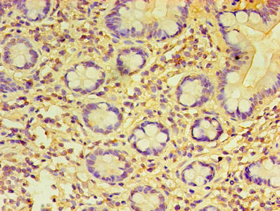 CSB-PA018603LA01HU