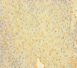 CSB-PA019043HA01HU