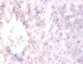 CSB-PA019557LA01HU