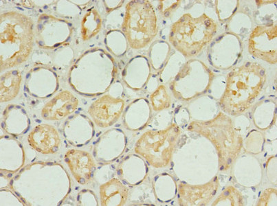 CSB-PA020650LA01HU