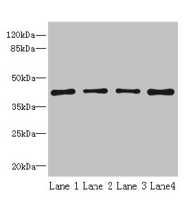 CSB-PA020650LA01HU