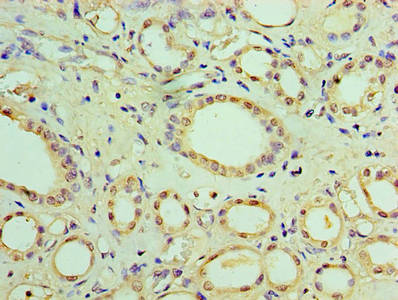 CSB-PA022388LA01HU