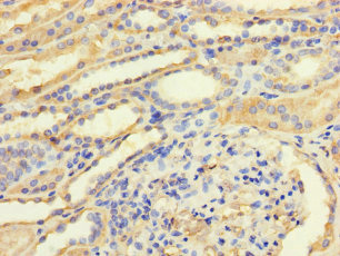 CSB-PA023449LA01HU