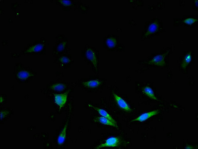 CSB-PA025556LA01HU