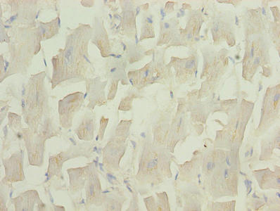 CSB-PA025556LA01HU