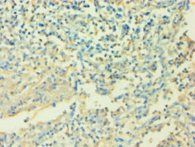 CSB-PA06757A0Rb IHC