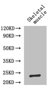 CSB-PA06757A0Rb WB