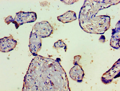 CSB-PA313364LA01HU