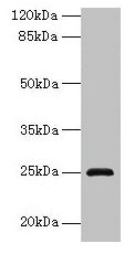 CSB-PA618795LA01HU