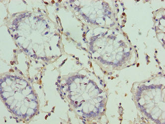 CSB-PA647983LA01HU
