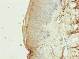 CSB-PA839298LA01HU