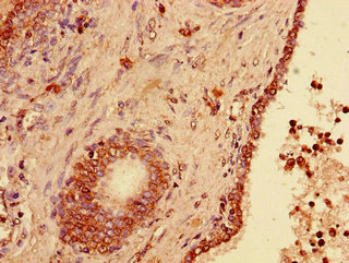 CSB-PA840583LA01HU