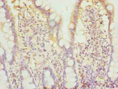 CSB-PA848825LA01HU