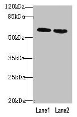 CSB-PA848825LA01HU