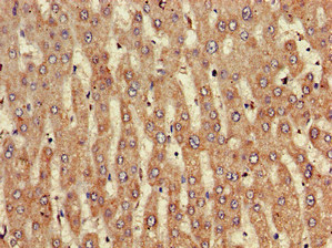 CSB-PA856441LA01HU