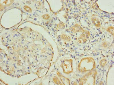 CSB-PA856927LA01HU