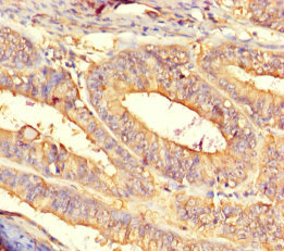 CSB-PA856967HA01HU
