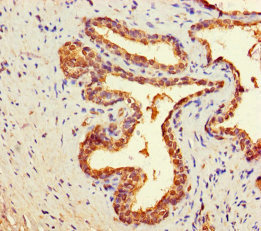 CSB-PA856967HA01HU