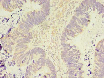 CSB-PA861124LA01HU