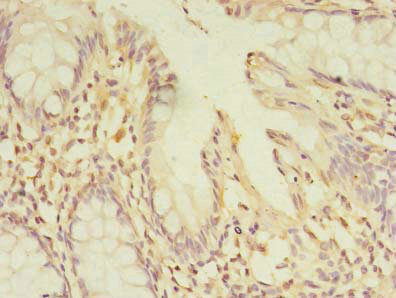 CSB-PA861124LA01HU