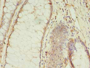 CSB-PA875636LA01HU